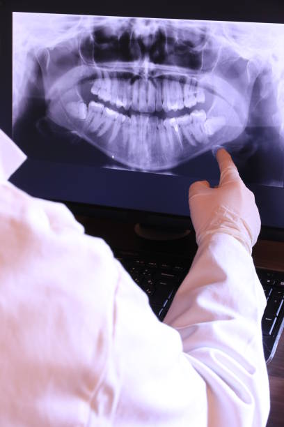 Best Emergency Dental Care for Broken or Chipped Teeth in Rotan, TX