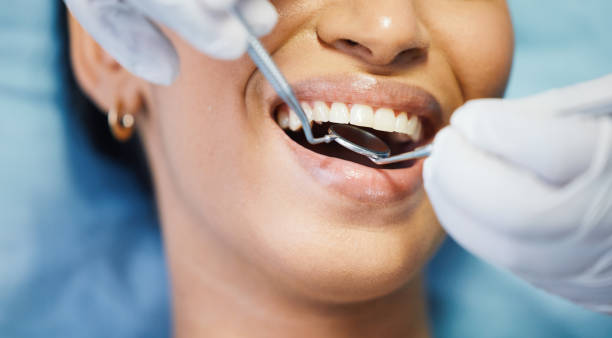 Best Emergency Root Canal Treatment in Rotan, TX